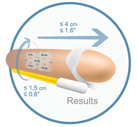 Andro Penis Results